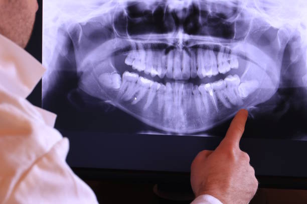 Best Emergency Gum Treatment in Orangeville, UT