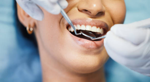 Best Emergency Wisdom Teeth Removal in Orangeville, UT